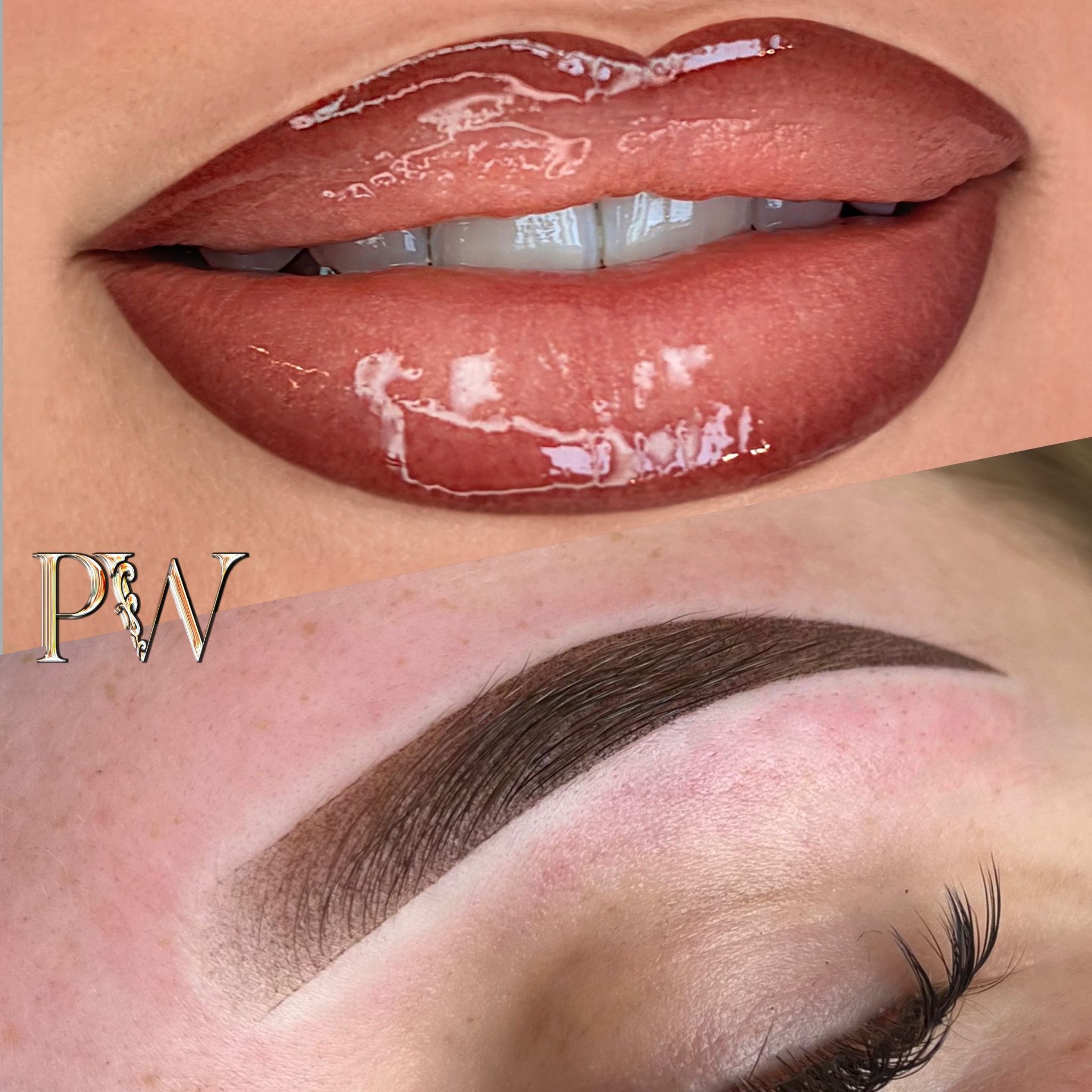 Belangrijkste Behandeling